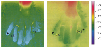 Without Ginkgo-Biloba Pharma Nord: After 10 minutes the skin temperature increases from 12.6 to approx. 20°