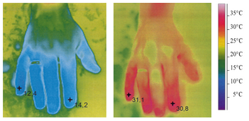 After using Ginkgo-Biloba Pharma Nord the skin temperature increases from approx. 13.8° to approx. 30.9° C after 10 minutes